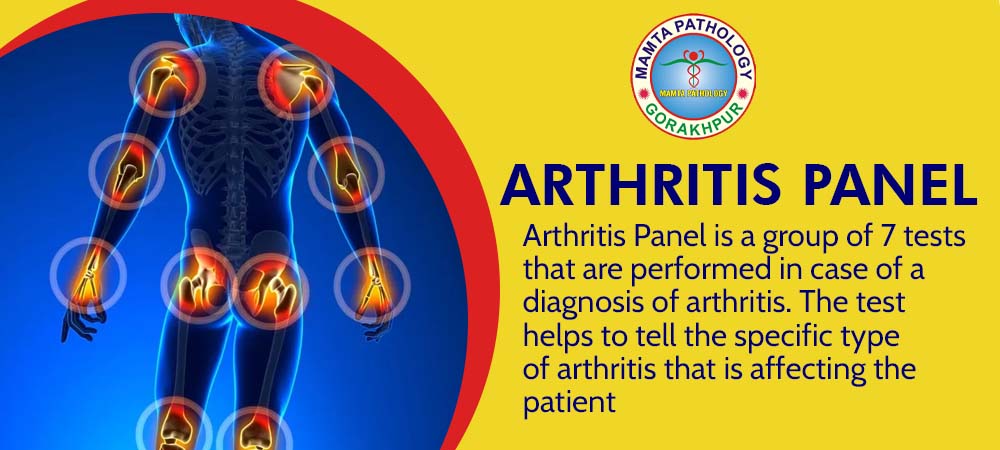 Arthritis Panel Test in Gorakhpur